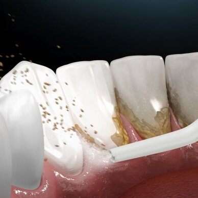 Burnos irigatorius Lanaform Hydrojet 3