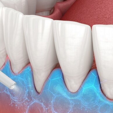 Burnos irigatorius Lanaform Hydrojet 5