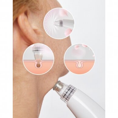 Acne dermabrasion device Lanaform Limpia 6